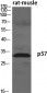 p57 Polyclonal Antibody
