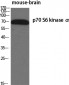 p70 S6 kinase α Polyclonal Antibody