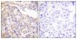 p70 S6 kinase α Polyclonal Antibody