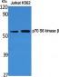 p70 S6 kinase β Polyclonal Antibody