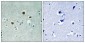 PAKβ Polyclonal Antibody