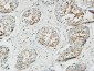 Patched Polyclonal Antibody