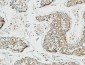 Patched Polyclonal Antibody