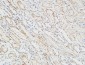 Patched Polyclonal Antibody