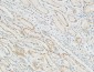 Patched Polyclonal Antibody