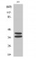 Pax-2 Polyclonal Antibody