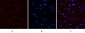 PDGF-B Polyclonal Antibody