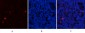 PDGF-B Polyclonal Antibody