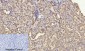 PDGF-B Polyclonal Antibody