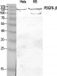 PDGFR-β Polyclonal Antibody