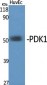 PDK1 Polyclonal Antibody