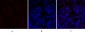 PERK Polyclonal Antibody