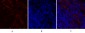 PERK Polyclonal Antibody