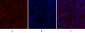 PERK Polyclonal Antibody