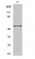 PFK-2 car Polyclonal Antibody