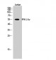 PFK-2 liv Polyclonal Antibody