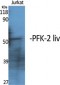 PFK-2 liv Polyclonal Antibody