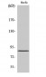 PFK-C Polyclonal Antibody