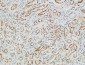 PGD Polyclonal Antibody