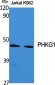 PHKG1 Polyclonal Antibody