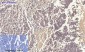 PI 3-kinase p110α Polyclonal Antibody