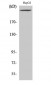 PIP5KIII Polyclonal Antibody