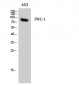 PKC ε Polyclonal Antibody