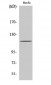 PKD1 Polyclonal Antibody