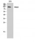 PKD2 Polyclonal Antibody