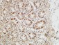 PKM2 Polyclonal Antibody