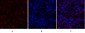 PKM2 Polyclonal Antibody