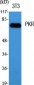 PKR Polyclonal Antibody