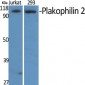 Plakophilin 2 Polyclonal Antibody