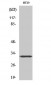 PMEPA1 Polyclonal Antibody