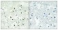 PMS2 Polyclonal Antibody