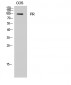 PR Polyclonal Antibody