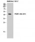 Presenilin 1 Polyclonal Antibody