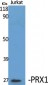 PRX1 Polyclonal Antibody