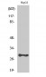 PSCA Polyclonal Antibody