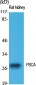 PSCA Polyclonal Antibody