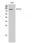 PSD-95 Polyclonal Antibody