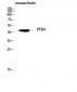 PTEN Polyclonal Antibody