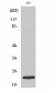 Rab 35 Polyclonal Antibody