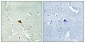 Rad23B Polyclonal Antibody