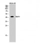 Rad51 Polyclonal Antibody