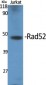 Rad52 Polyclonal Antibody