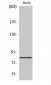 Radixin Polyclonal Antibody