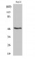 RARβ Polyclonal Antibody