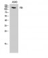 Rb Polyclonal Antibody