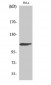 Rb Polyclonal Antibody